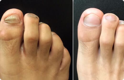 Novo resultado do tratamento com Suai Repair