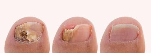 Resultados do tratamento com Suai Repair